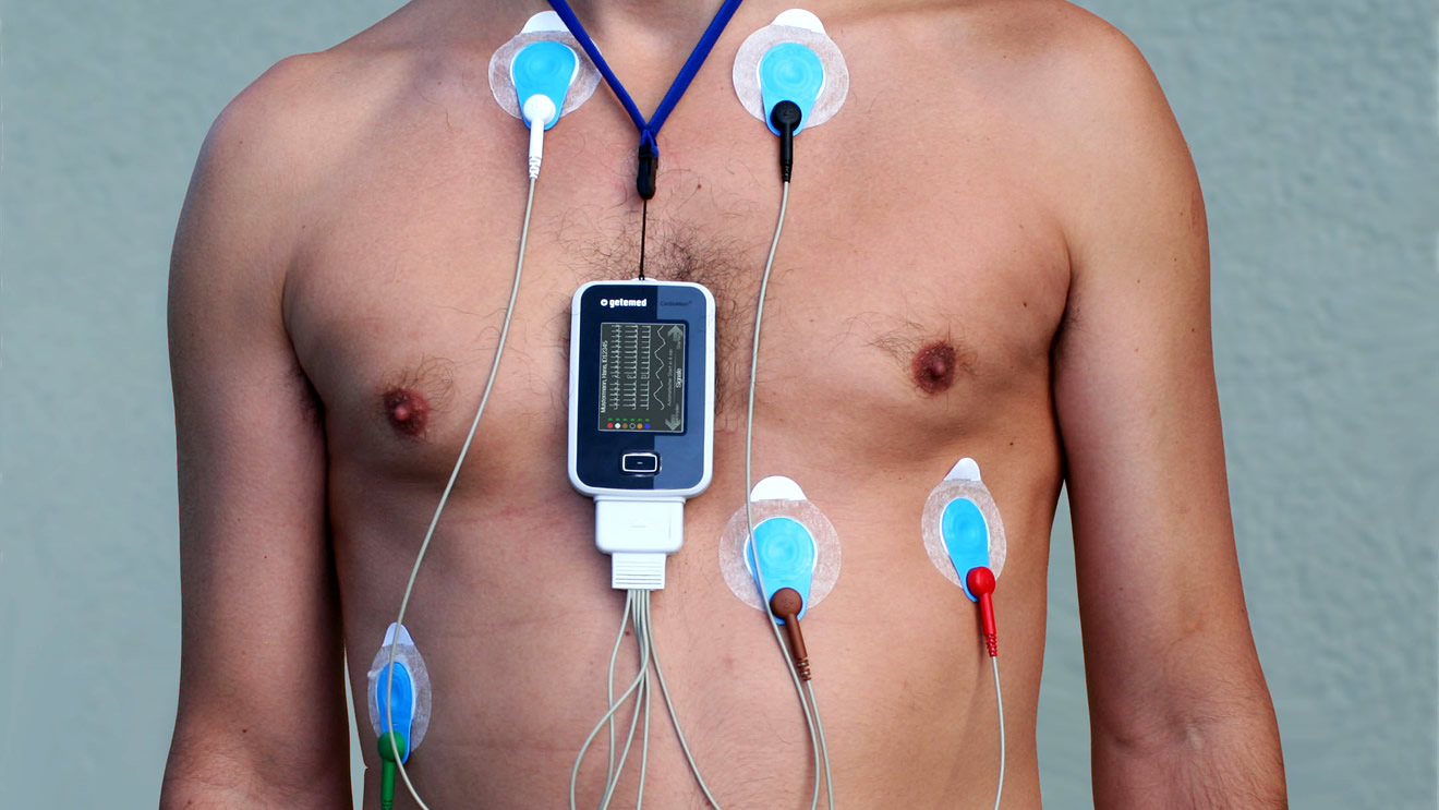 Holter Cardíaco
