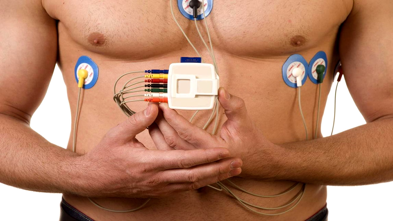 Holter Cardíaco